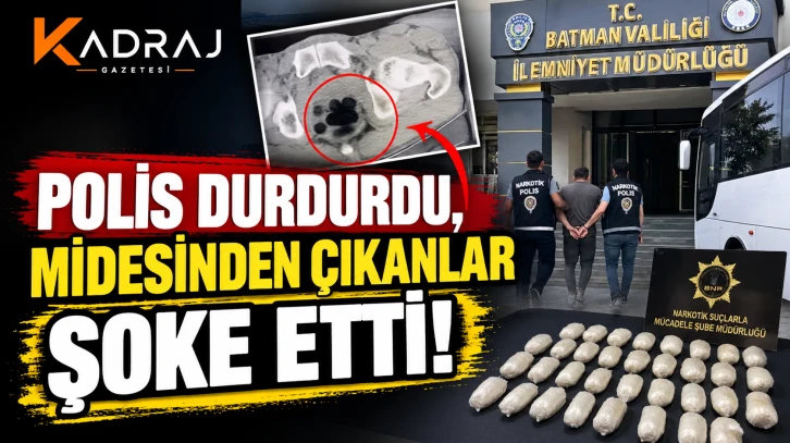 Polis Durdurdu, Midesinden &Ccedil;ıkanlar Şoke Etti!